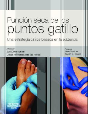 Punción seca de los puntos gatillo